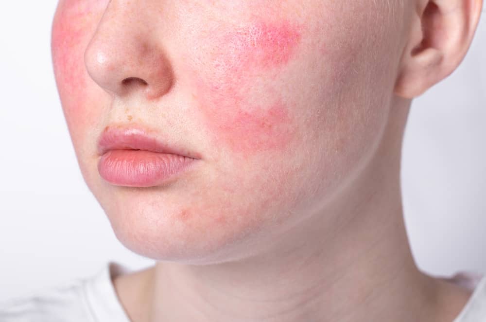 پنج عامل اصلی ایجاد مشکلات پوست