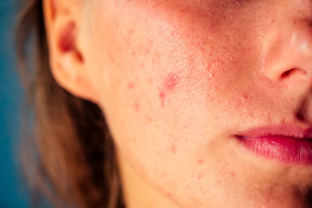 10 اشتباه که به پوست شما آسیب وارد می کند